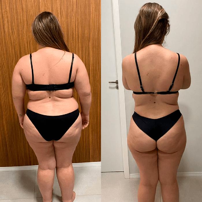 Antes e depois de aluna da Tropa
